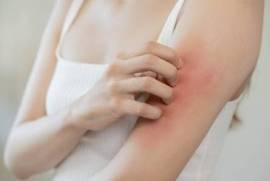 Texas Allergy Group, PLLC, United States, 77449