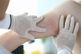 Allergy doctors near me, United States, 77090