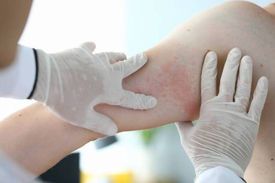 Allergy doctors near me, United States, 77090