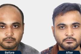 HairFree and HairGrow Clinic - Bhopal, India, 462026