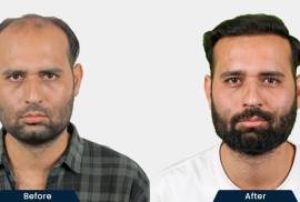 HairFree and HairGrow Clinic - Mumbai, India, 400069