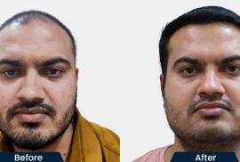 HairFree and HairGrow Clinic - Nagpur, India, 440010