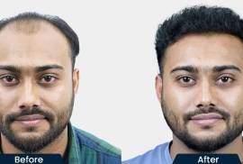 HairFree and HairGrow Clinic-Pimple, India, 411061