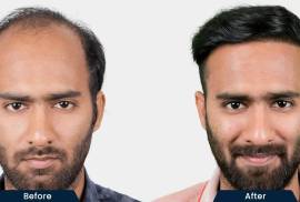 HairFree and HairGrow Clinic - Hyderabad, India, 500034