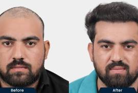HairFree and HairGrow Clinic - Ahmedabad, India, 380057