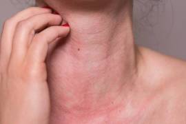 Texas Allergy Group, PLLC, United States, 77043